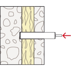 FISCHER FIWETTERSCHALEN_SANIERSYSTEM_FWS_II